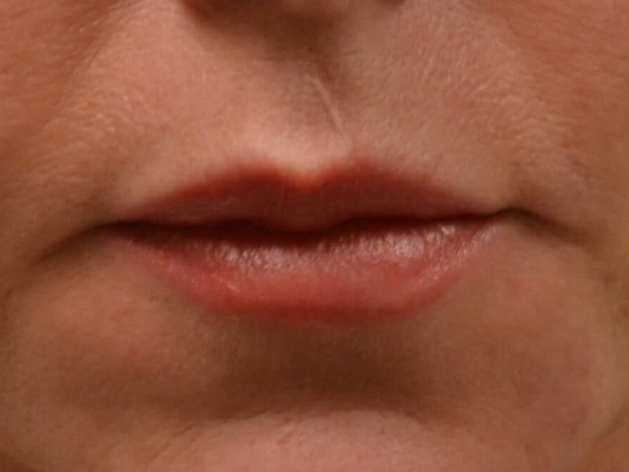Before Image