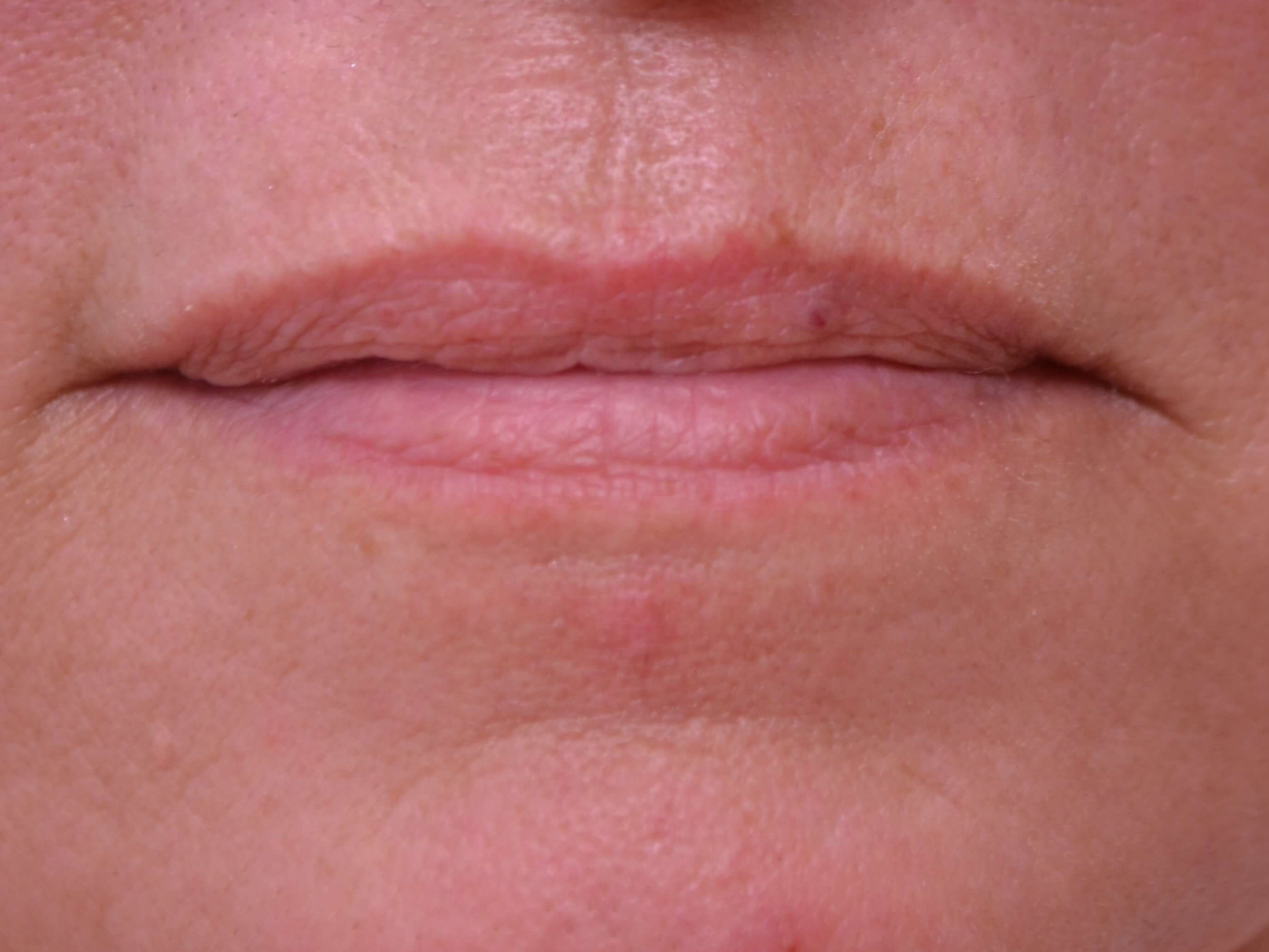 Before Image