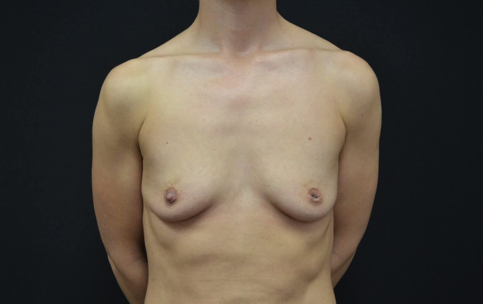 Before Image